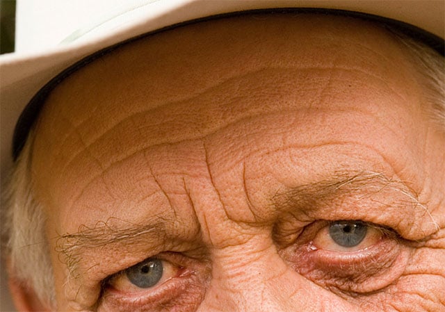 Un primer plano de la frente del hombre que muestra las arrugas originales.  Imagen © 2016 Photoshop Essentials.com