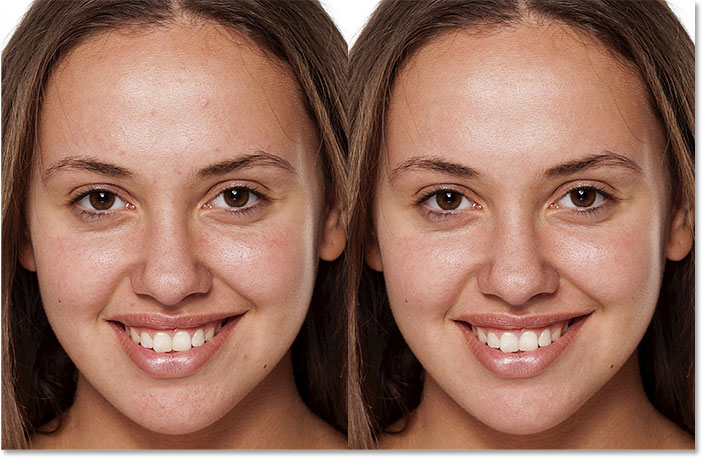 Una comparación de antes y después de la limpieza de la piel con el Pincel corrector puntual en Photoshop