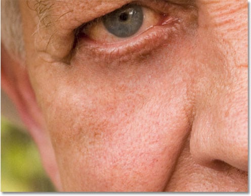 Continúe eliminando la arruga más grande debajo del ojo del hombre con el Healing Brush.  Imagen © 2010 Photoshop Essentials.com