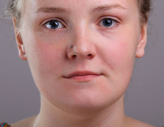 Cómo eliminar el acné y las imperfecciones de la piel con Spot Healing Brush en Photoshop