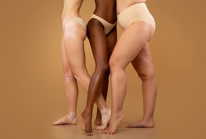 Mujeres árbol con diferentes razas y tamaños corporales posando con un paso adelante.